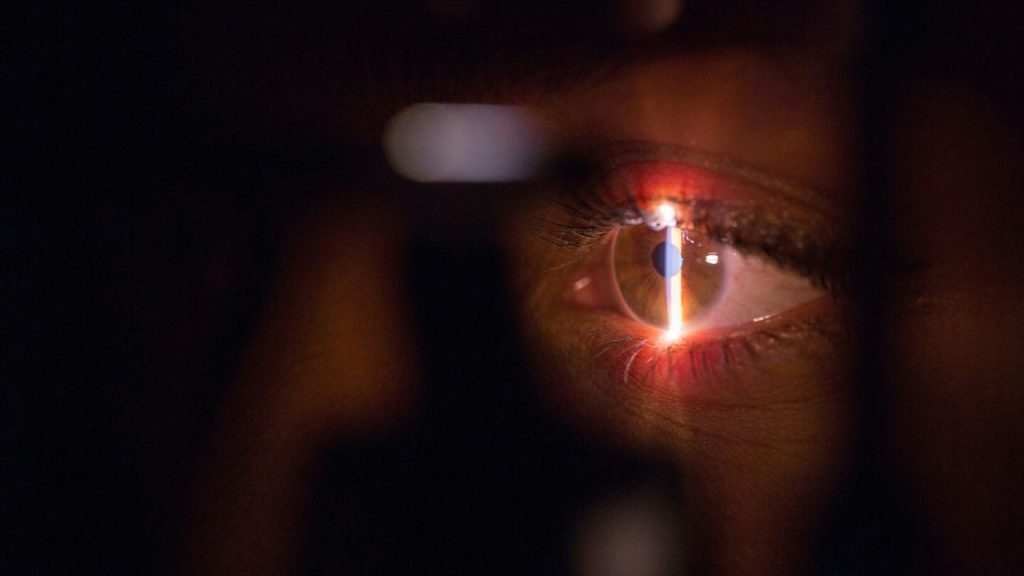 a close up photo of a human eye with a beam of light projected down the centre of the iris, depicting the scanner which the company Optos developed to scan inside the back of the human eye.