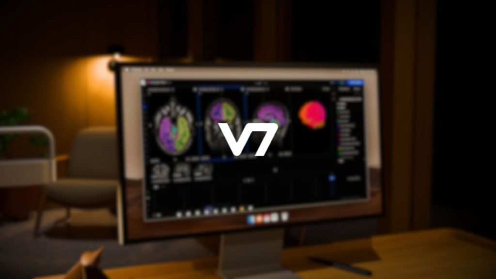V7 company logo overlaid on a photo of a computer screen on a desktop in a home office setting which is displaying some scans of a brain being arranged using the V7 Go platform.