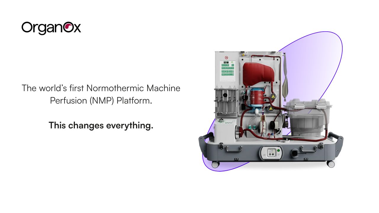 OrganOx Metra Normothermic Machine Perfusion technology, keeping livers ready for transplant for longer than cold storage.