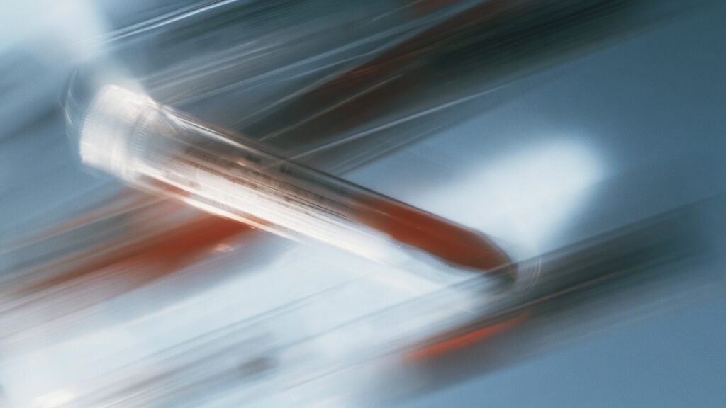 AI-generated image of a blood vial.